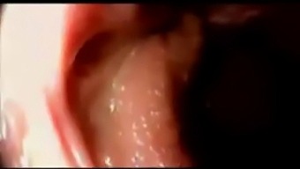Intense Internal Ejaculation: A Continuation